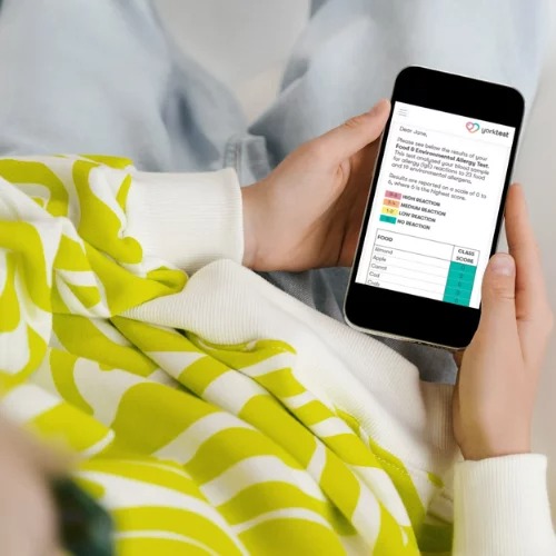 Allergy-Test-Example-Results